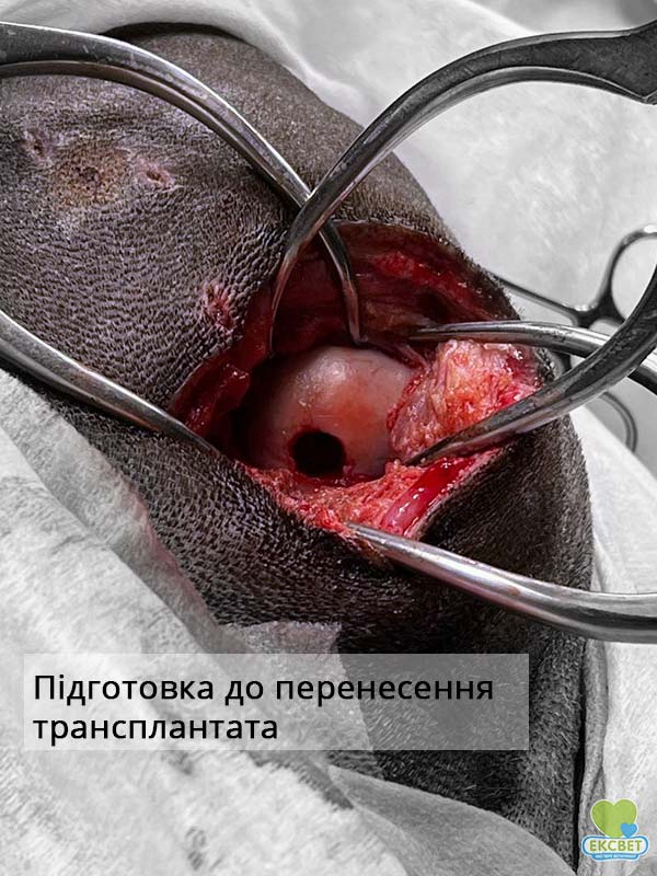 Аутоостеохондропластика - етап операції, підготовка суглобової поверхні до перенесення трансплантата