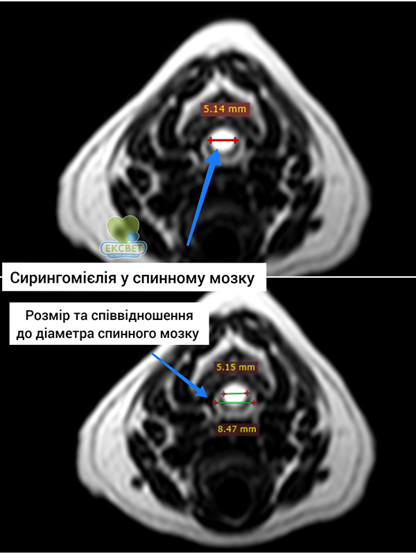 Сирингомієлія у спинному мозку собаки. МРТ, поперечний зріз,співвідношення до розміру мозку