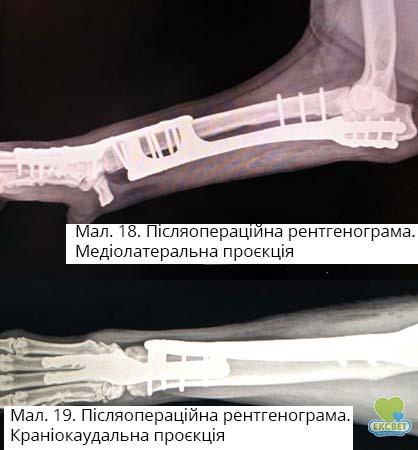 Післяопераційна рентгенограма.