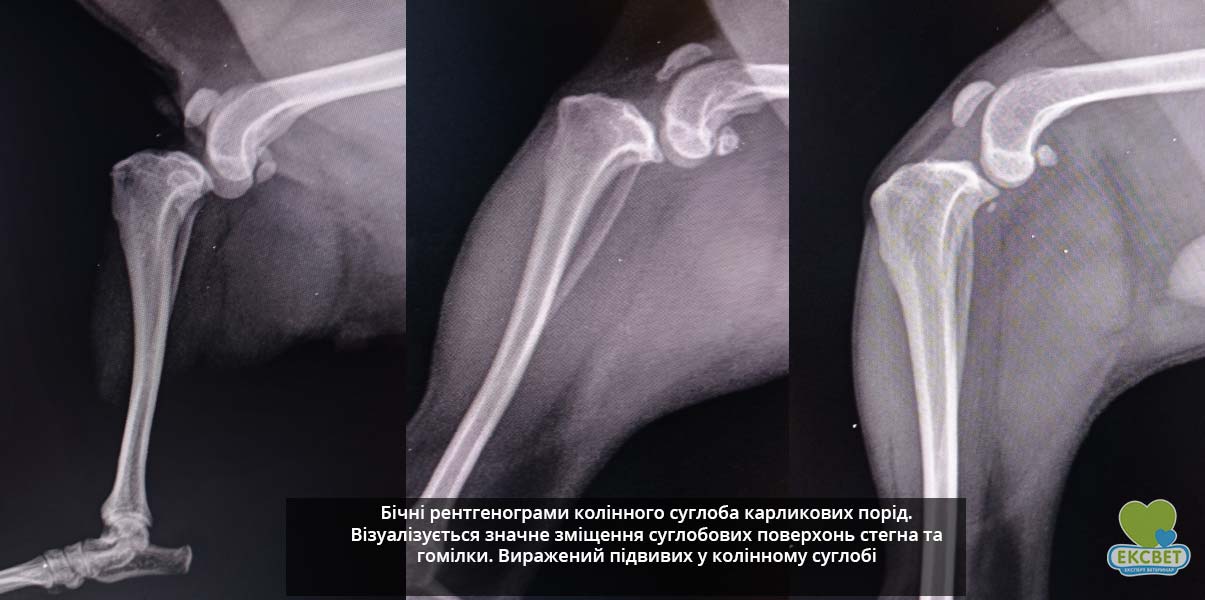 Карликова порода. Бокова медіолатеральна рентгенограма. Візуалізується значне зміщення стегна щодо гомілки (підвивих колінного суглоба). Діагноз РПХЗ+МВКЧ.